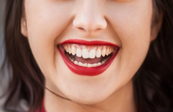 Smile