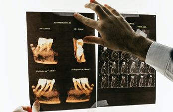 X-Ray